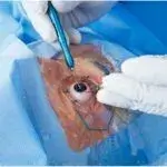 Eye Hospital Gurgaon