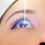 ReLex SMILE eye hospital near