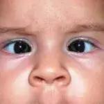 Eye Doctor Near Me