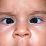 eye care specialists