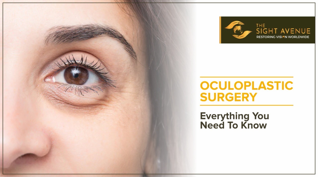Oculoplastic Surgery – Everything You Need To Know
