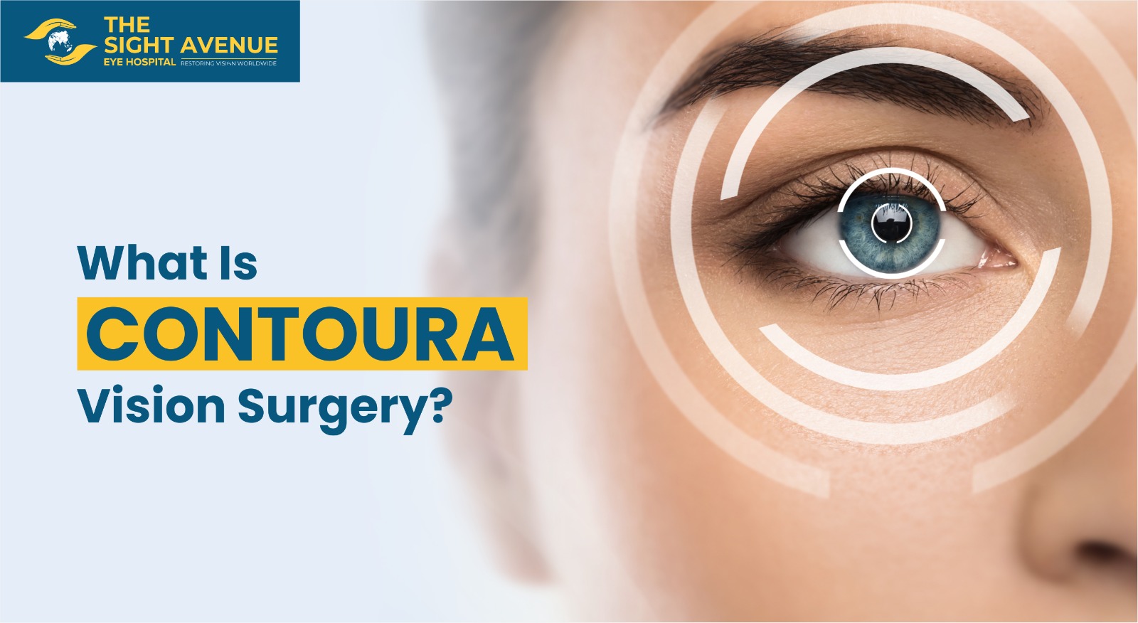 What Is Contoura Vision Surgery