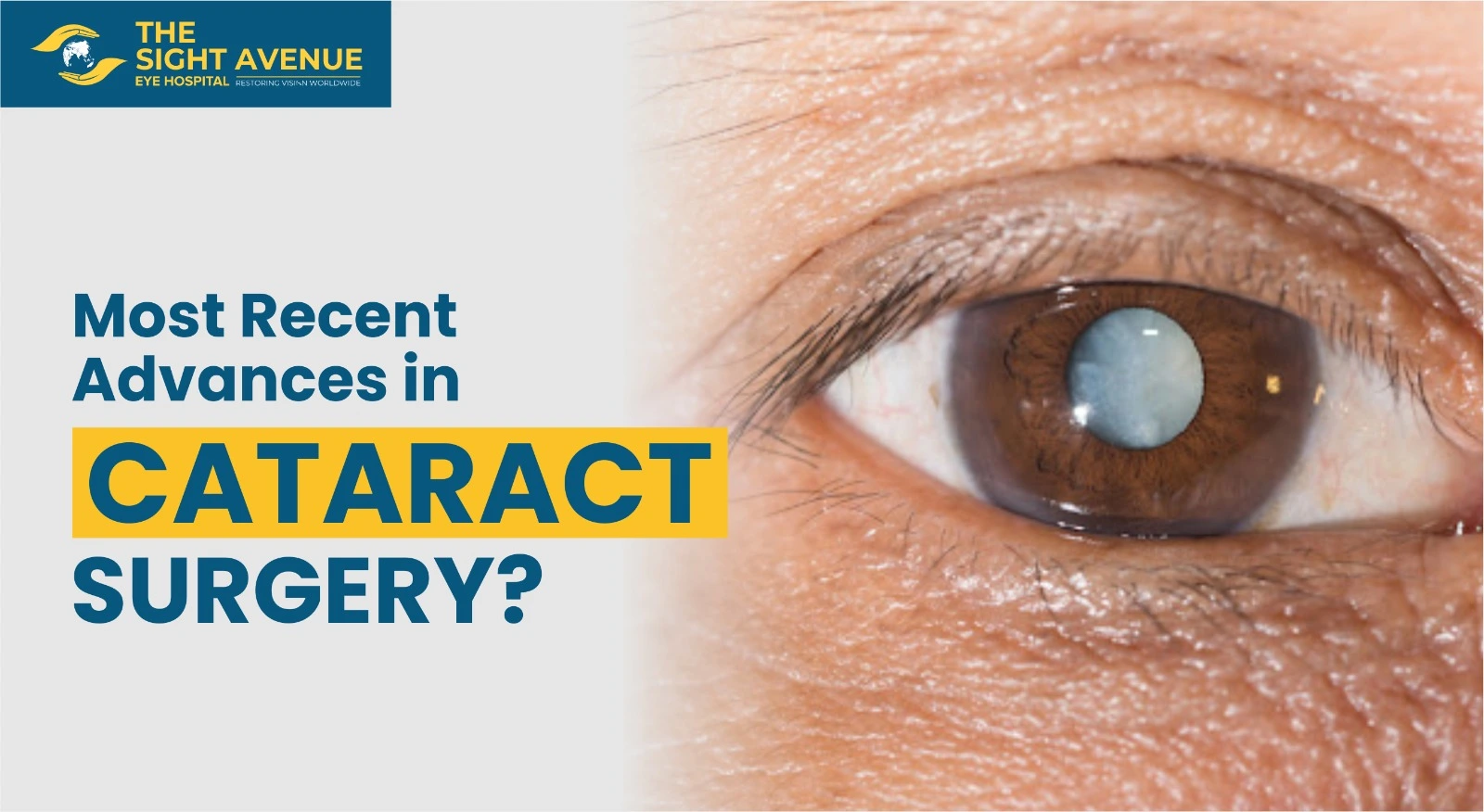 Most Recent Advances in CATARACT SURGERY?