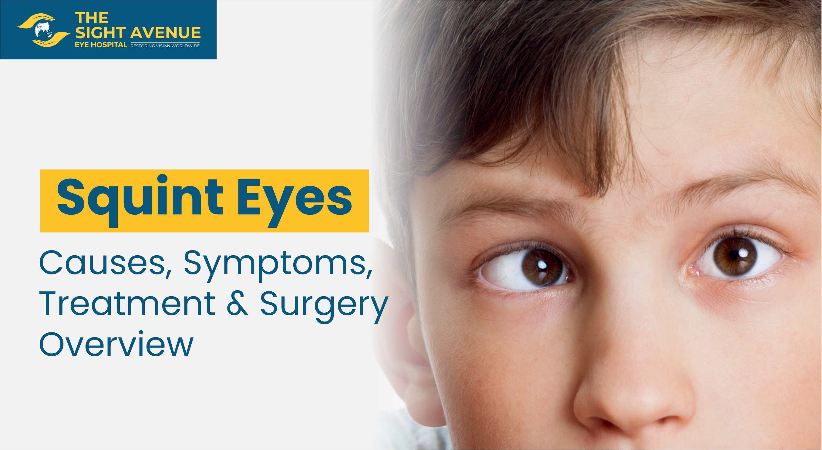 Squint Eyes: Causes, Symptoms, Treatment & Surgery Overview