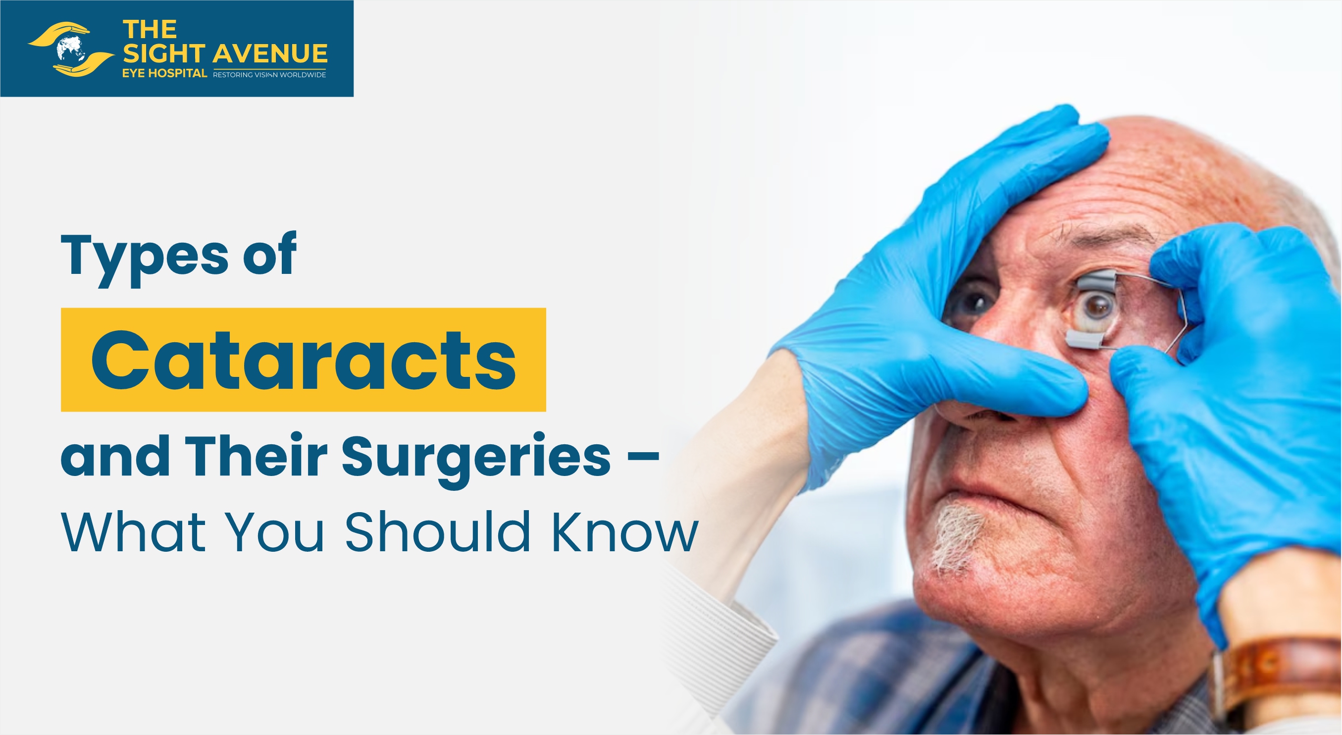 Types of Cataracts and Their Surgeries – What You Should Know