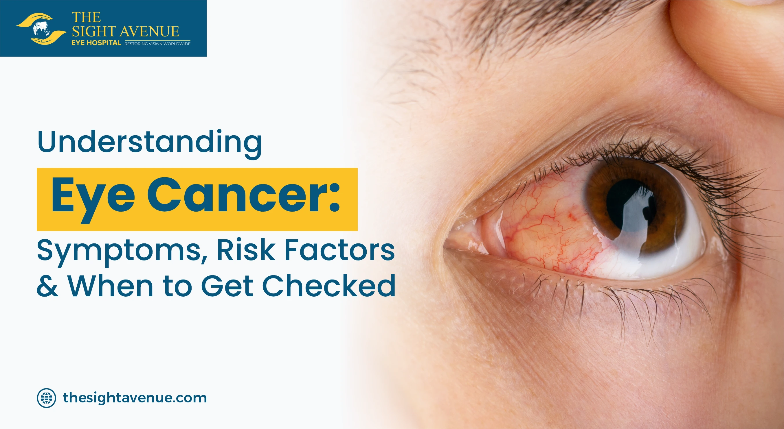 All About the Cost of Retinal Detachment Surgery