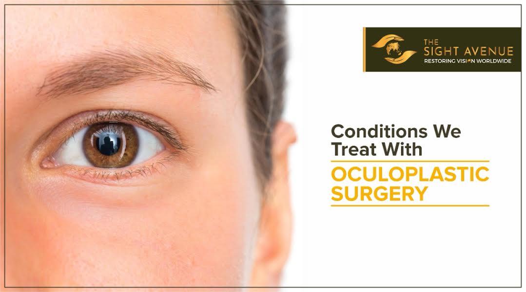 Conditions we treat with Oculoplastic Surgery | Best Oculoplastic Surgeon in Delhi